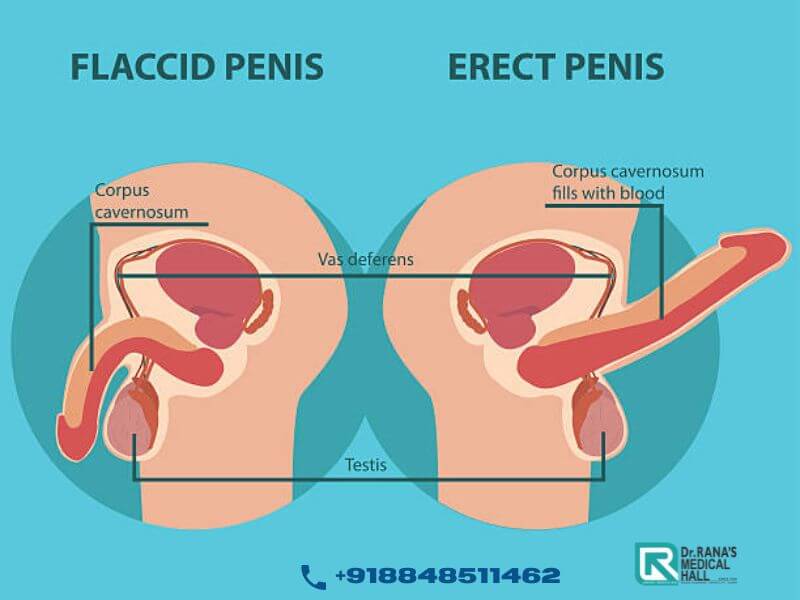 Effective Penile enhancement treatment